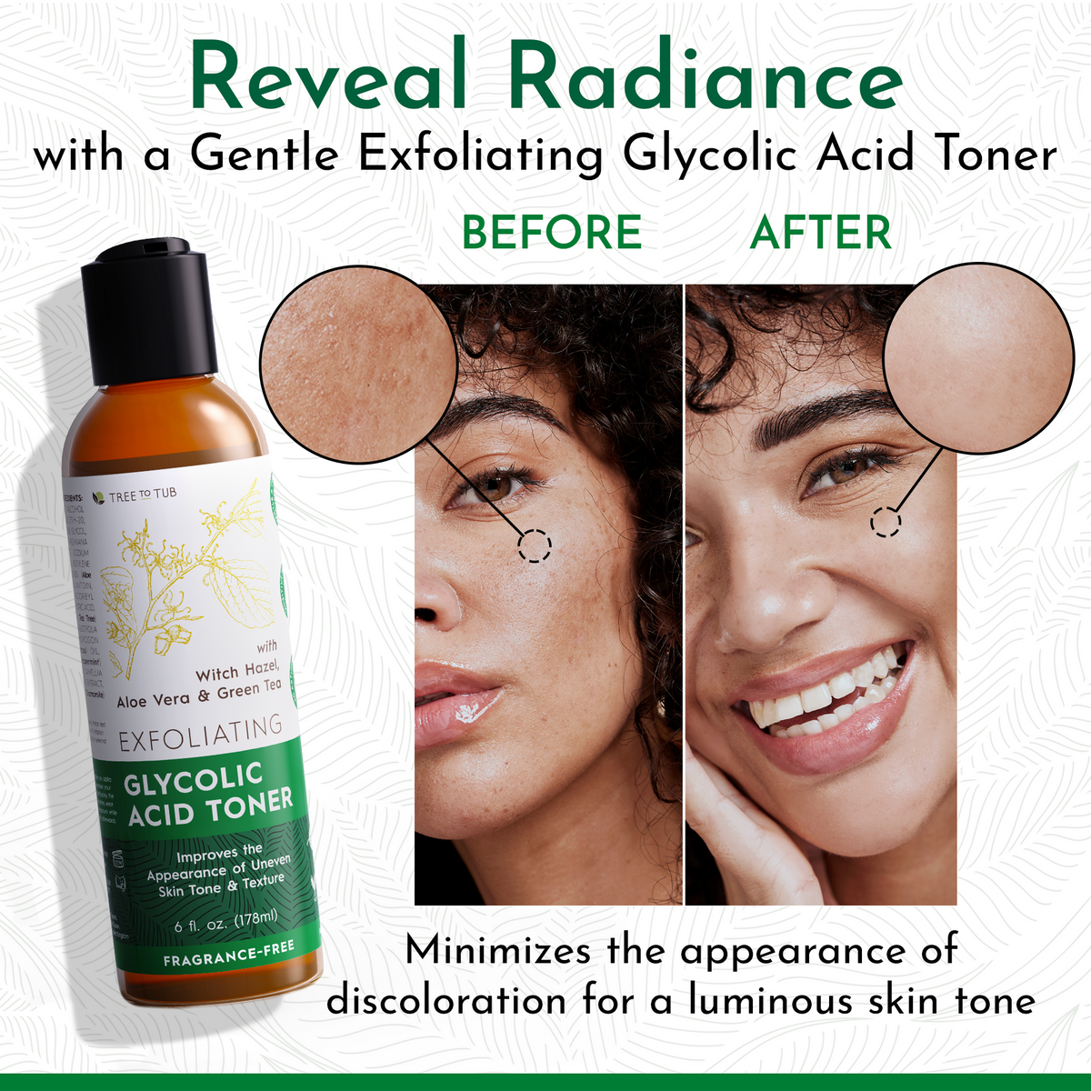 Exfoliating Glycolic Acid Toner – Tree To Tub