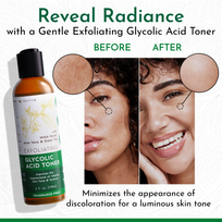 Exfoliating Glycolic Acid Toner