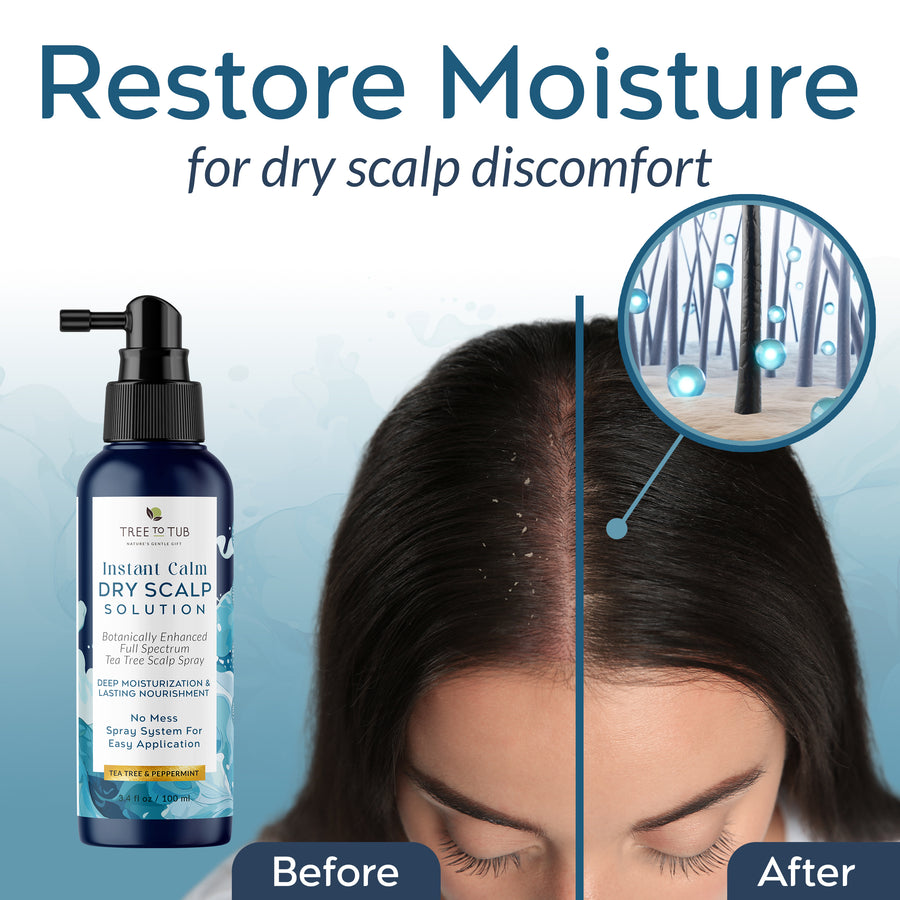 Instant Calm Dry Scalp Solution